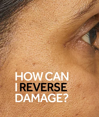 Your Skin Damage Questions Answered