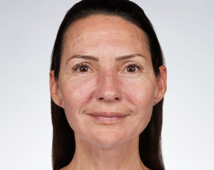 BEFORE USING FUTURE RENEW SERUM