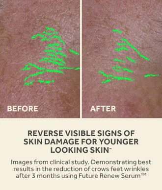 reverse visible signs of skin damage for younger looking skin