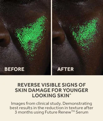 reverse visible signs of skin damage for younger looking skin