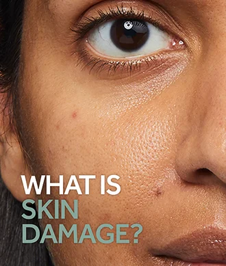 Your Skin Damage Questions Answered